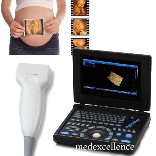 3d pc 10.4&#034;tft lcd color full digital laptop ultrasound scanner linear ce fda for sale