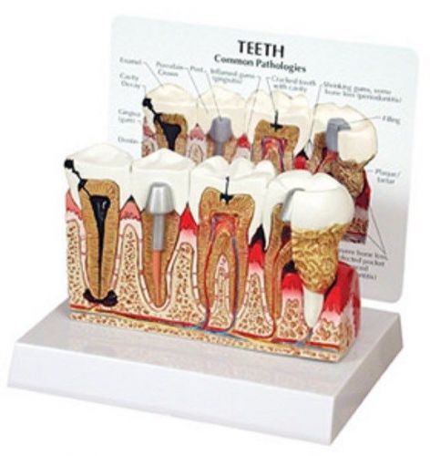 NEW Anatomical Human Dentist Dental Teeth Tooth Model