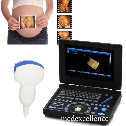 3D PC 10.4&#034;TFT LCD Color Full Digital Laptop Ultrasound Scanner Convex CE FDA