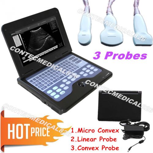 Notebook Digital Ultrasound  scanner with 3 probes  (CONVEX+Linear+Micro Convex)