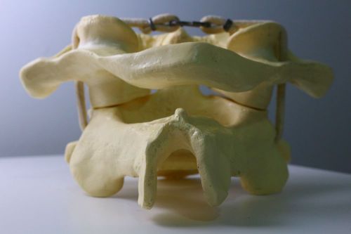 Large Upper Cervical Atlas Axis Vertebrae Model