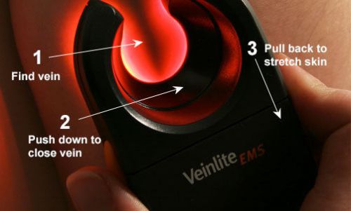 Veinlite ems adult baby vein finder transilluminator for sale