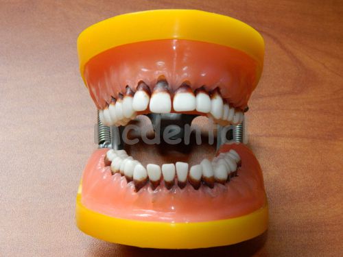 NEW ADULT TYPODONT DENTAL MODEL PERIODONTAL DISEASE TEETH SCALING DEEP ROOT