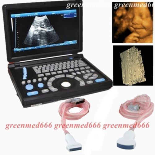 HD PC Mornitor 3D Full Digital Laptop Ultrasound Scanner+ Linear+Convex probeFDA