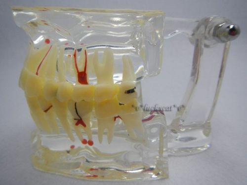 New Dental Teeth Study Model Classic Implant Model with Restoration