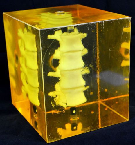 Vertebrae Sculpture In Resin Anatomy Model of Spine