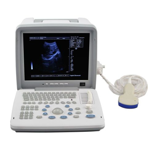 12&#039;&#039; Full Digital LCD Ultrasound Machine Scanner System +3.5MHz convex Probe+3D