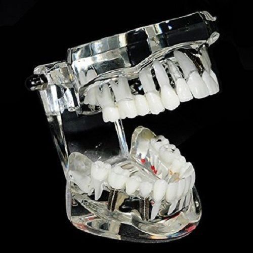 Teeth Dental Anatomy Model Adult Removable Tooth Study Teaching Dental School