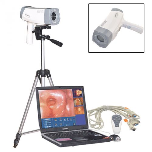 Digital Electronic Colposcope SONY Camera 800,000 pixels 1/4&#034;optical zoom lends