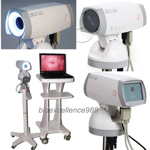 HOT FDA CE Digital Video Electronic Colposcope SONY Camera 830,000 pixels