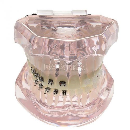 Orthodontics Dental Metal Ceramic Bracket typodonts brace#3003 Study Teeth model