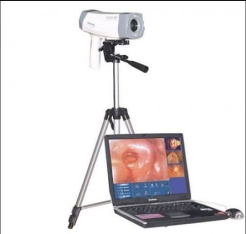 CA -Sale!!!Digital Video Electronic Colposcope+Software SONY 800000 pixel -UPS