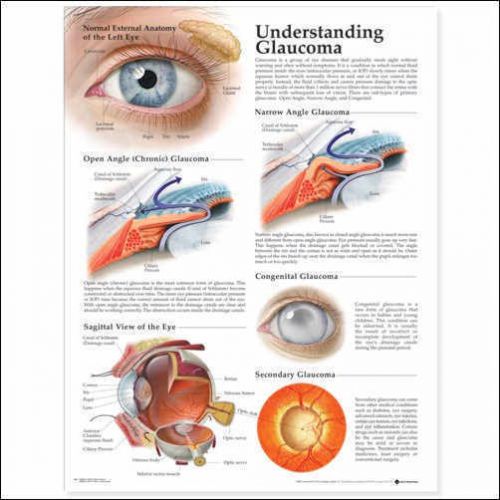 UNDERSTANDING GLAUCOMA, LAMINATED ANATOMICAL CHART, 20 X 26