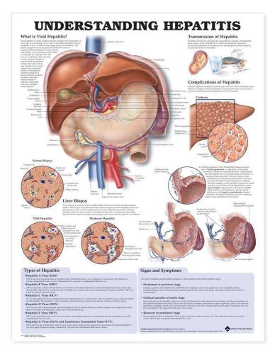 UNDERSTANDING HEPATITIS, LAMINATED ANATOMICAL CHART, 20 X 26