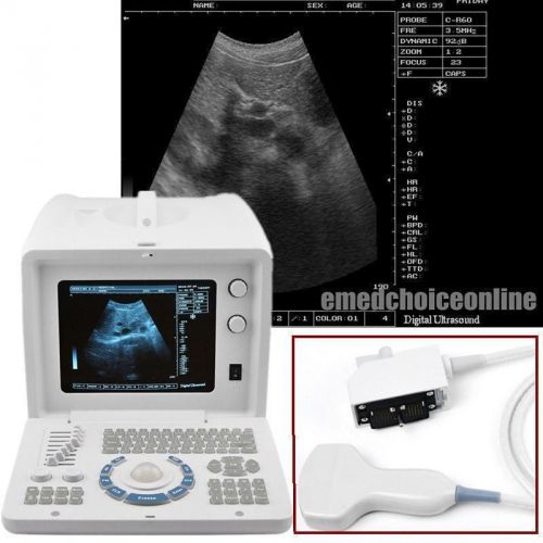 Digital Ultrasound Scanner Machine Portable -3.5 Mhz Convex Probe-EXT 3D BID BID