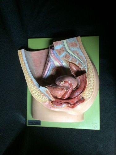 Somso - ms1 median section of the female pelvis anatomical model, 2 part (ms 1) for sale