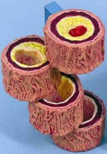 NEW Anatomical Artery Cholesterol Atherosclerosis Model