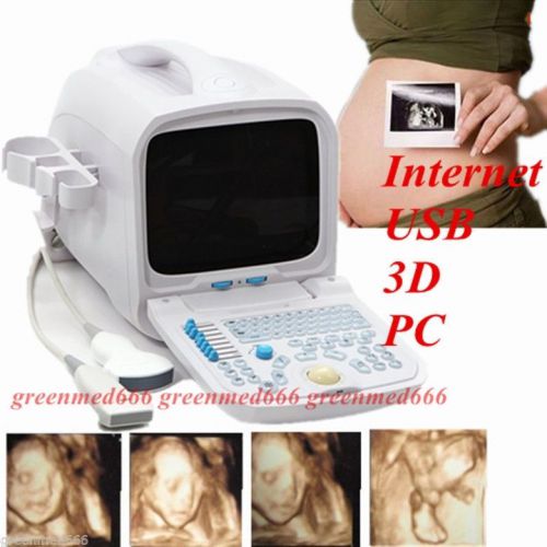 3d pc platform ultrasound scanner +7.5mhz linear &amp;3.5mhz convex probe internet for sale