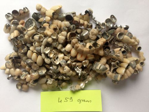 459  GRAMS DENTAL SCRAP NO GOLD