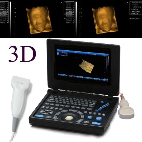 3D PC Full Digital Laptop Ultrasound Scanner Machine Convex Linear 2 Probes CE