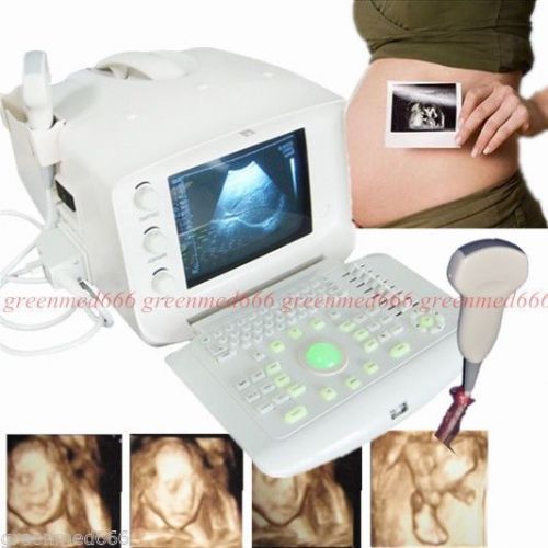 2015 Version Portable Ultrasound Scanner /Machine with 3.5Mhz Convex Probe 2015