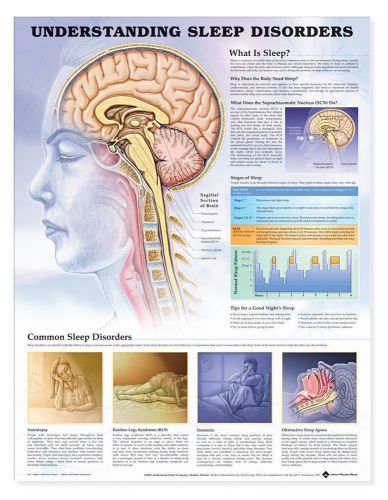 UNDERSTANDING SLEEP DISORDERS, LAMINATED ANATOMICAL CHART, 20 X 26