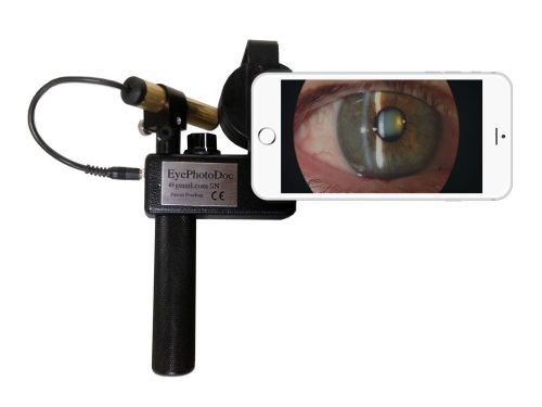 Photographic Redefining i-Slit Lamp for iPhone 6/6s/6sPlus by EyePhotoDoc