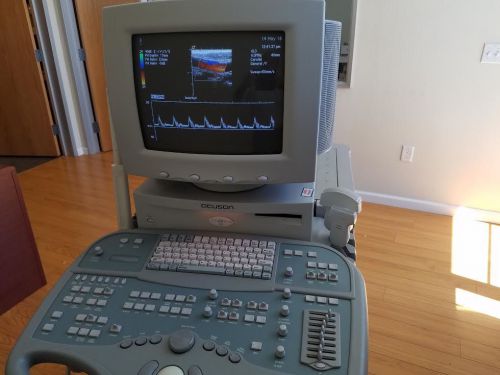 Siemens Seqouia 512  Abdominal ,OB,GYN  ,Vascular Color Doppler  Ultrasound