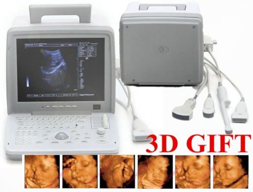 Factory!! 12.1inch Digital Laptop Ultrasound Scanner+Convex+ Transvaginal Probe