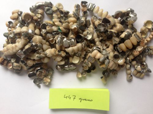 447  GRAMS DENTAL SCRAP NO GOLD