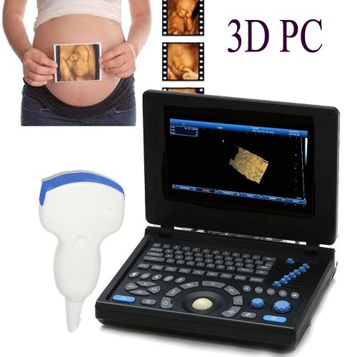 High-resolution Color Full Digital Laptop Ultrasound Scanner PC Convex Probe 3D