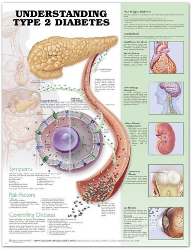 UNDERSTANDING TYPE 2 DIABETES, LAMINATED ANATOMICAL CHART, 20 X 26