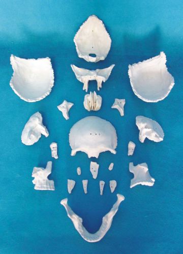 RS Human Skull Disarticulated  Anatomical Model Professional 22 parts education