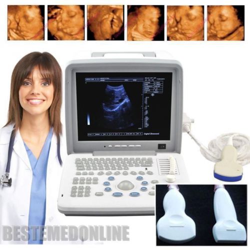 Portable Digital Ultrasound Scanner Machine + Convex + Linear Probe +3D BID BID