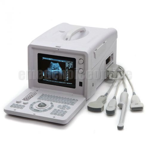 High image Full Digital Ultrasound Scanner(2 probe connector) + convex probe