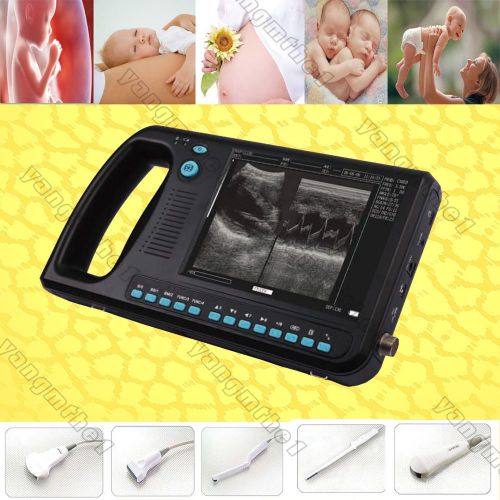 Palm Smart B-ultrasound ultrasound Scanner System +convex probe, Scanner system