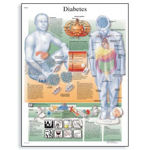 3B Scientific Glossy Laminated Paper Diabetes Mellitus Anatomical Chart VR1441L