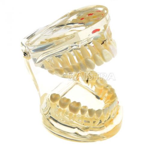 SALE Dental Adult Pathologies Demonstration Study and Teach Teeth Model 4019-II