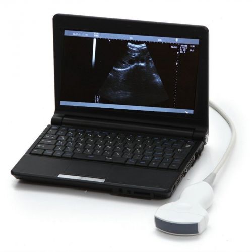 2015 Brand new Digital Laptop Ultrasound Scanner/Machine System + 3.5MHz Convex