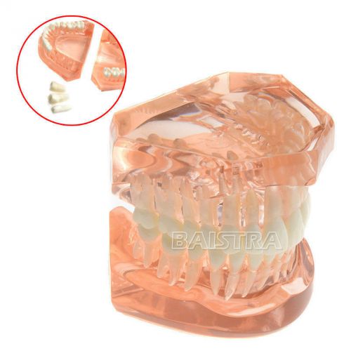 NEW Dental Teeth Study Teaching Model Removable ADULT TYPODONT Model