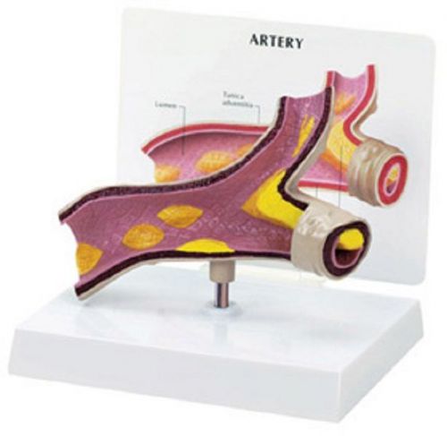 Anatomical human artery oversized &#034;y&#034; section model overstocked returned for sale