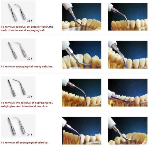 Dental ultrasonic scaler scaling tip g1 g2 g3 g4 fit ems &amp; woodpecker for sale