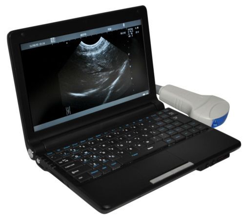 BID 10.1&#039; Laptop Ultrasound-Scanner Ultrasound System 3D*Convex+ Micro-convex!!