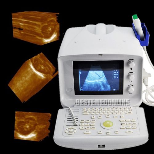 CE Portable digital Ultrasound Scanner 3.5 MHZ CONVEX probe external 3D image