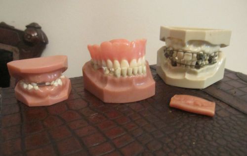 vintage rare fake teeth Columbia Dentoform baby typodont braces dental display