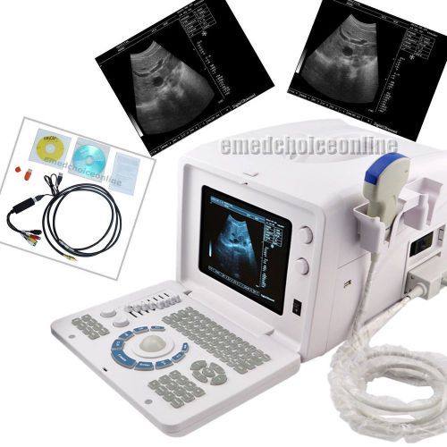 NEW CE SVGA Portable Full Digital Ultrasound Scanner 3.5MHZ CONVEX 3D software