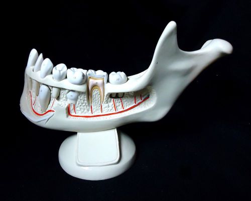 Denoyer Geppert - Giant Hands-On Child’s Jaw Teeth Anatomical Tooth Model