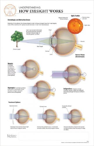 11 x 17 post-it anatomical chart: how eyesight works for sale