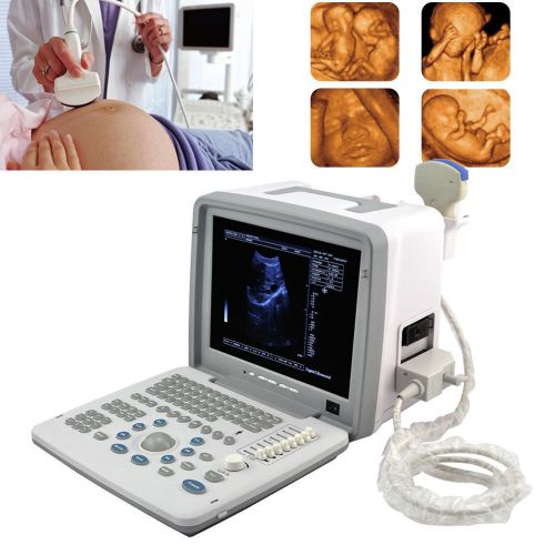 3D Full Digital Portable Ultrasound Scanner convex PROBE 3D workstation FDA CE