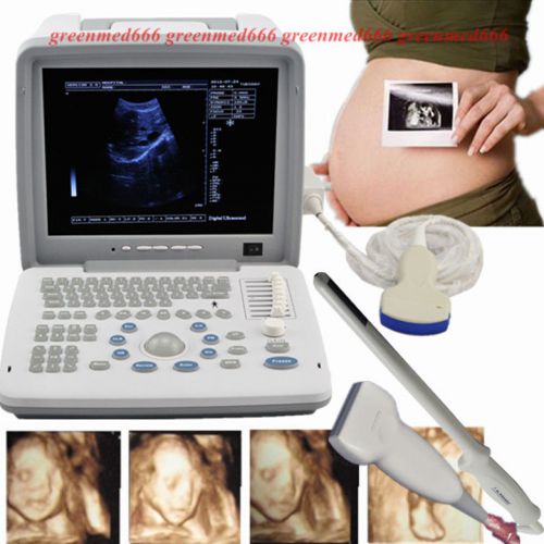 3D Full Digital Portable Ultrasound Scanner +Convex&amp;Linear&amp;Transvaginal 3 Probes